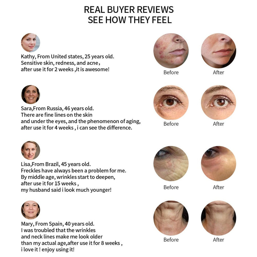 5 in 1 LED Skin Tightening