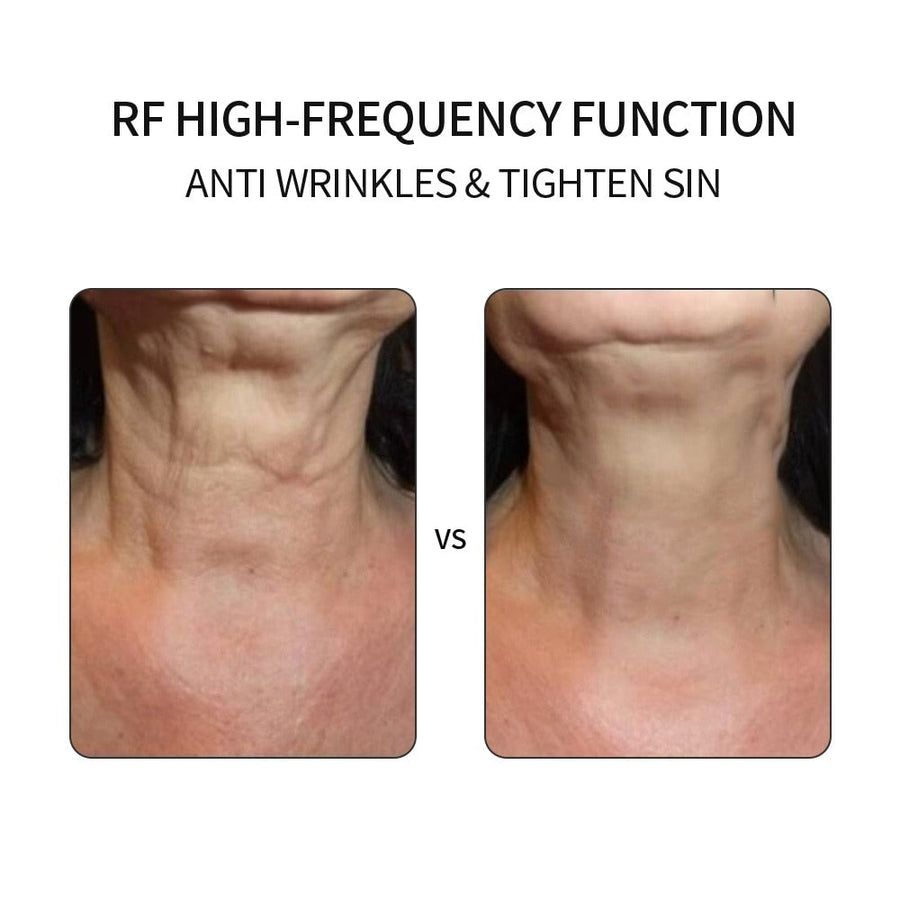 5 in 1 LED Skin Tightening