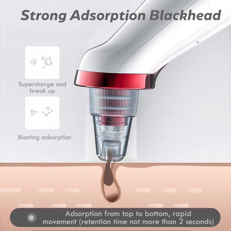 Electric Vacuum Blackhead Remover - PerfectSkin™