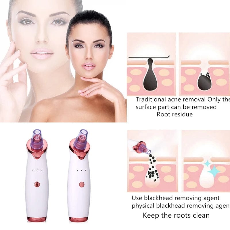 Electric Vacuum Blackhead Remover - PerfectSkin™