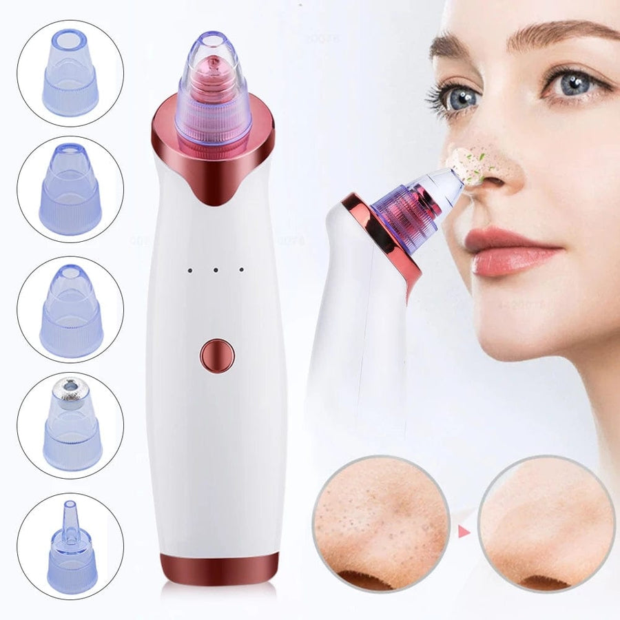 Electric Vacuum Blackhead Remover - PerfectSkin™