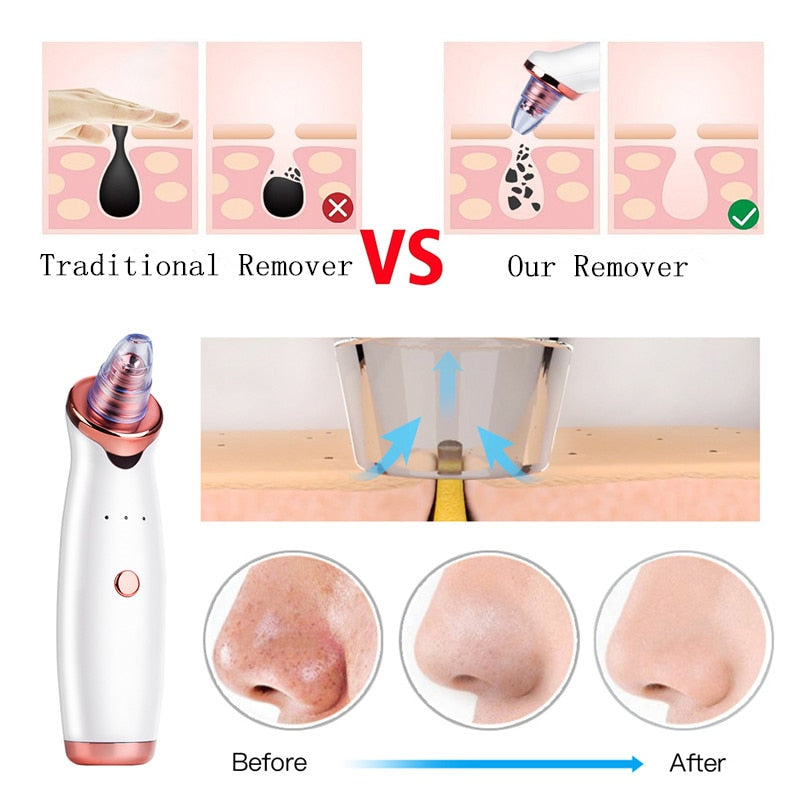 Electric Vacuum Pore Cleanser