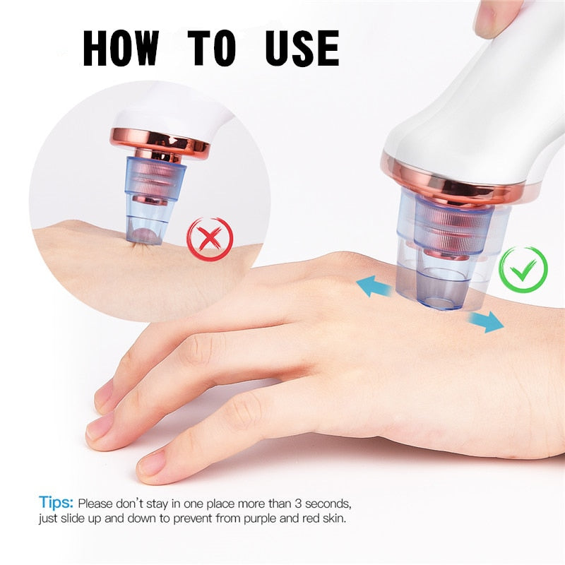 Electric Vacuum Pore Cleanser
